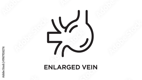 Enlarged Vein and Aneurysm Medical Icon Set, Linear Vector Illustration of Vascular Swelling, Blood Vessel Health, Circulatory System Anatomy, Varicose Vein Treatment and Phlebology Diagnostic Symbol