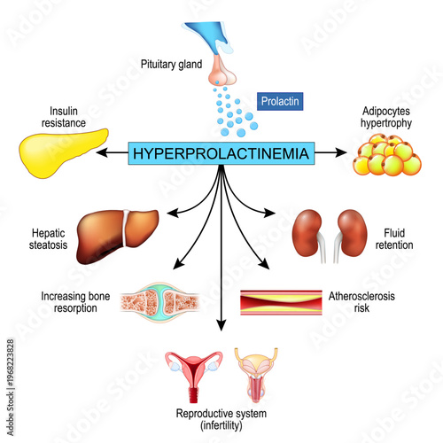 Effects of hyperprolactinemia. Pituitary disorder
