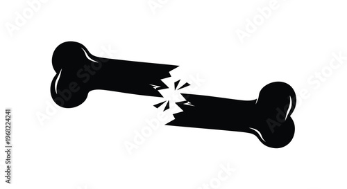 Broken bone illustration with sharp fracture a stark black silhouette
