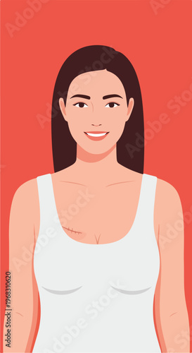 A smiling woman wearing a white tank top with a small surgical scar on her chest