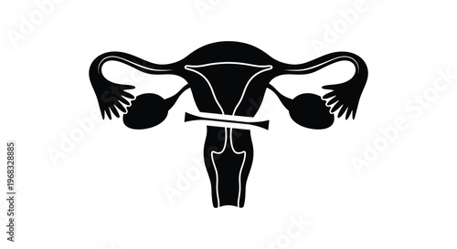 Anatomical illustration of a female uterus in stark black silhouette