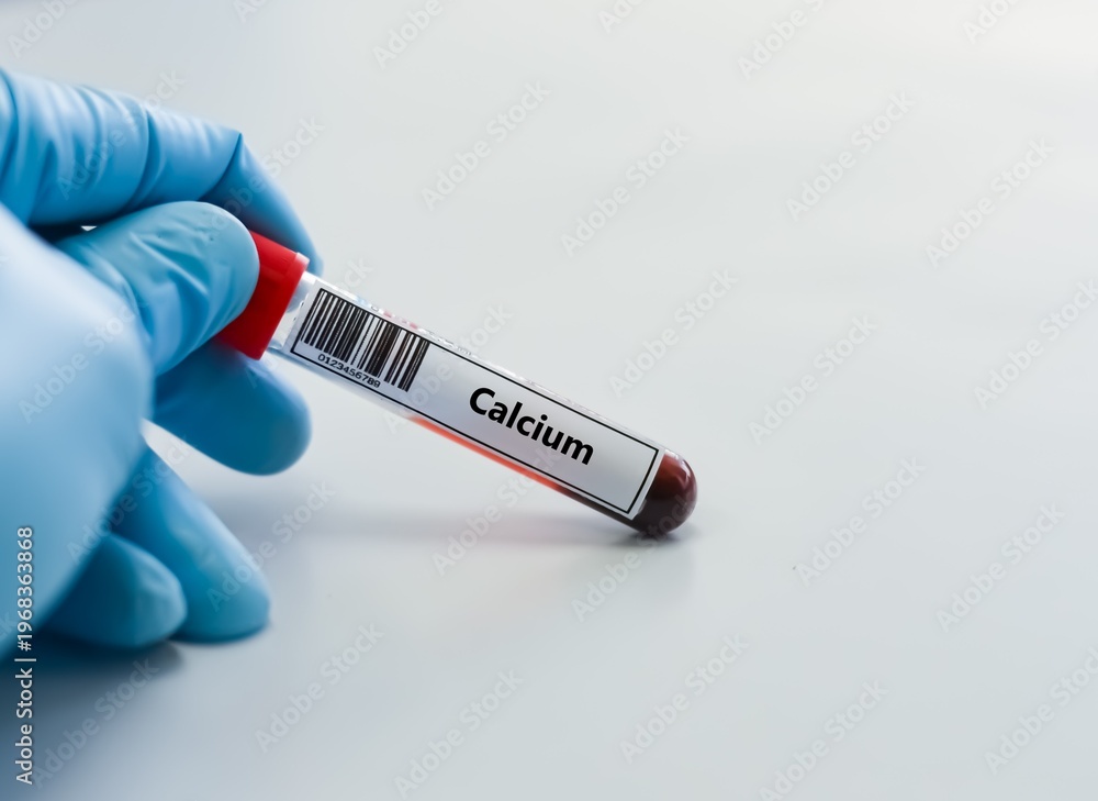 Fototapeta premium Blood sample tube for calcium test analysis.