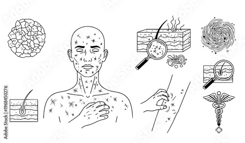 A vector graphic illustration depicting a man with skin conditions and various related medical icons and graphics
