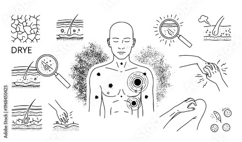A vector graphic illustration of a man with various skin conditions and symptoms depicted around his body including eczema acne and dry skin with magnifying glasses and hands inspecting the skin