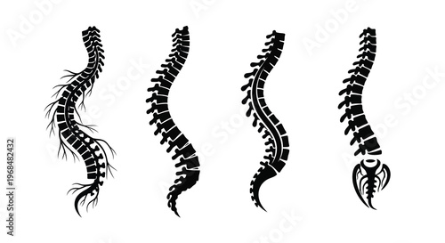 Four spinal columns illustrating varying degrees of curvature silhouette