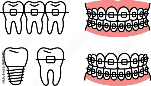 A collection of dental illustrations showing teeth alignment and dental implants for oral care