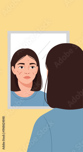 A sad woman looks at her acne-prone reflection in a mirror, feeling self-doubt