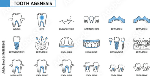 Medical collection of tooth agenesis icons featuring dental implants bridges crowns and missing teeth for stomatology education,