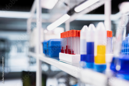 Foto Close up of blood samples in test tubes arranged on laboratory shelf rack