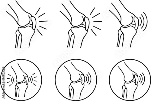 Knee Joint Pain and Swelling Icon Set Featuring Line Art Illustrations with Sound and Pain Indicators for Health and Medical Applications