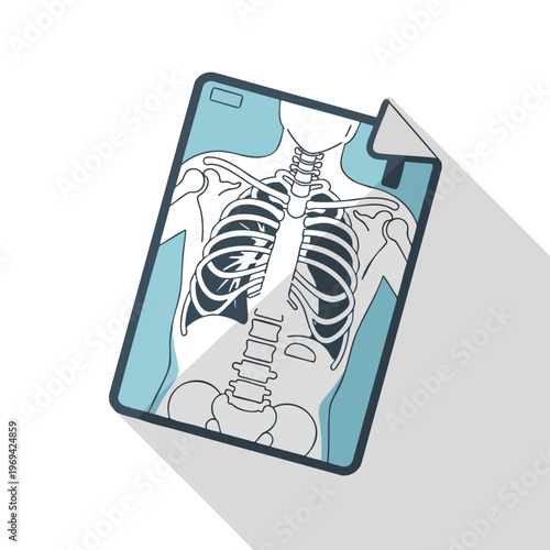 Flat design x-ray of a human torso, showing bones and ribs