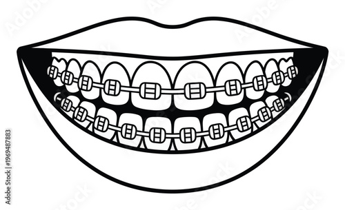 Stylized Black and White of Teeth with Braces