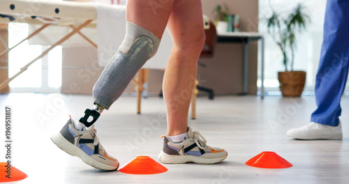 Foto Doctor, patient or disc with cones on prosthetic leg for mobility training or balance in clinic