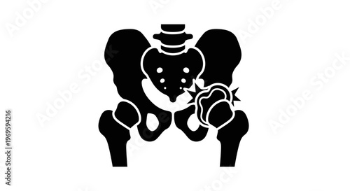 Black Silhouette of Human Pelvis Bone Icon