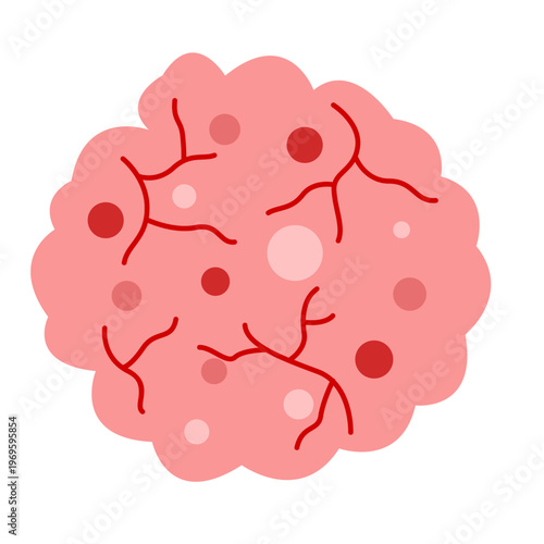 cancer tumor cell developing concept