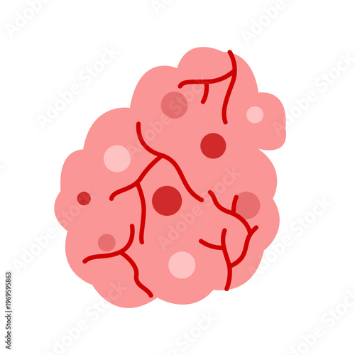 cancer tumor cell developing concept