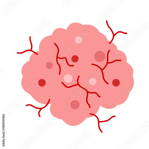 cancer tumor cell developing concept
