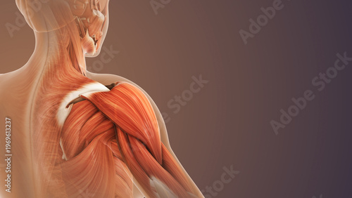 Quadro em tela Injured Shoulder Muscle with Pain and Inflammation