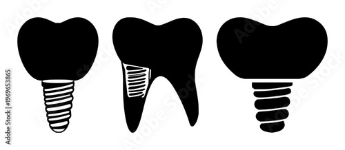 Dental implant tooth icon set with solid black shape on white background featuring dental implant, tooth, icon with vector and minimalist design