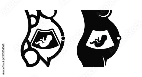 Set of icons of a pregnant woman with an ultrasound scan of a baby inside the belly
