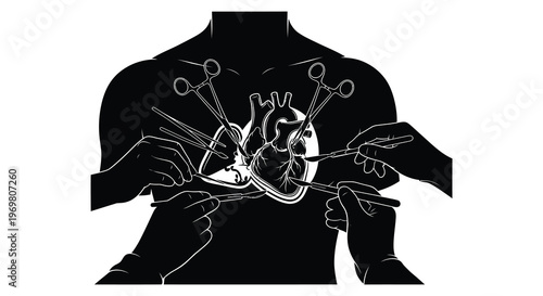Surgical intervention on a heart depicted as a striking black silhouette