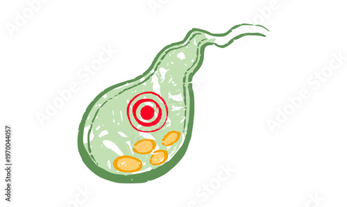 Human Gallbladder Disease