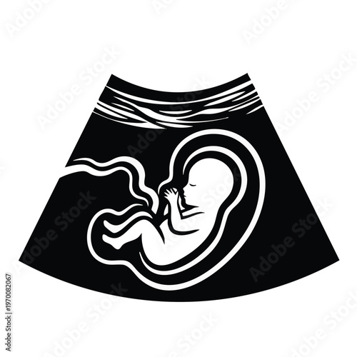 Ultrasound fetus vector icon. Pregnancy and prenatal care medical illustration. Isolated graphic element