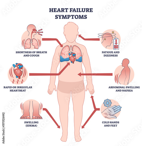 Heart failure symptoms overview shows a human silhouette with heart and lungs, arrows highlighting breathlessness, edema, and fatigue for quick patient education, transparent background.