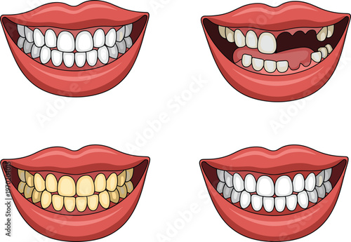 Teeth and mouth set, dental health smiles vector illustration cartoon isolated oral hygiene dentistry concept