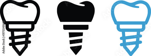 Dental implants three stages of illustration black grey and blue