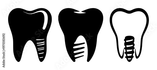 Dental implant tooth icon set with solid black shape on white background featuring dental implant, tooth, icon with vector and minimalist design