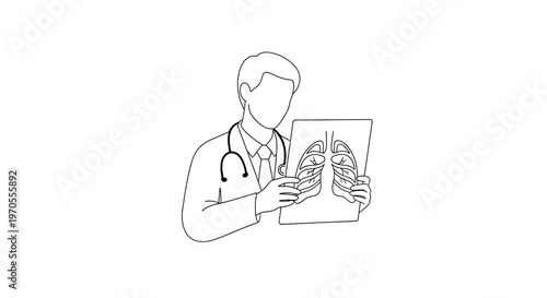 Doctor holding lung x-ray image.