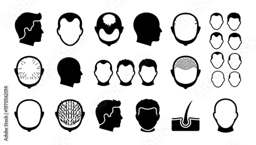 Hair Loss Icon Set – Baldness, Hairline, Scalp and Alopecia Silhouette Collection