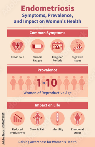 Medical infographic about endometriosis showing common symptoms prevalence and impact on women health. Includes pelvic pain chronic fatigue irregular periods digestive issues reduced productivity infe