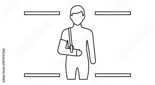 Man with arm in cast, medical injury, broken bone, recovery, healthcare concept