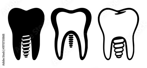 Dental implant tooth icon set with solid black shape on white background featuring dental implant, tooth, icon with vector and minimalist design