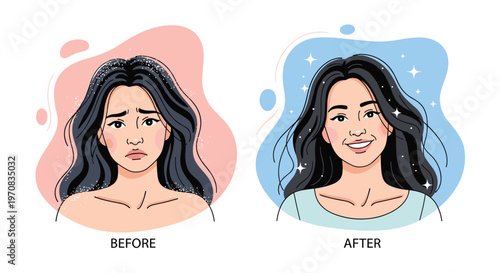 Comparison showing a woman with dandruff and oily hair before treatment and her clean, shiny hair in the after result.
