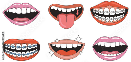 cartoon lips and mouth expressions collection, vibrant vector illustration with teeth, tongue and braces, smiling female characters, creative assets for comics, stickers, emojis, and character design 