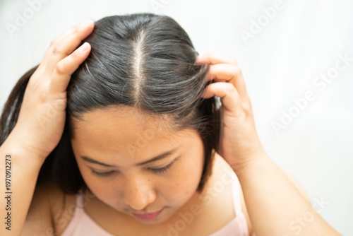 Asian women have problems with itchy scalp and dandruff.