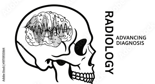 Radiology advancing diagnosis concept with human skull and brain waves.