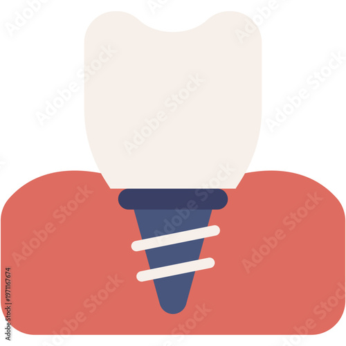 Dental Implant Prosthesis Vector Icon for Orthodontic Care
