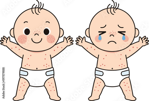 Baby rash allergy skin irritation infant eczema symptoms healthcare problem dermatology child crying itching illustration medical condition