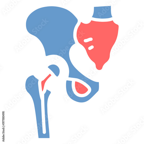 Hysterectomy Vector Icon