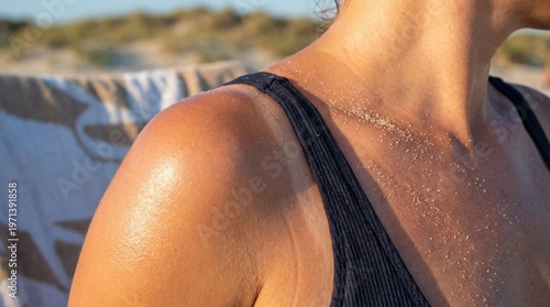 Billede på lærred Close-up of a person's red, sunburnt shoulder with peeling skin after severe UV sun exposure
