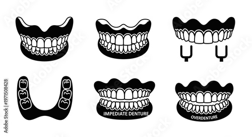 Dental Prosthetics Set: Dentures, Implants, and Overdentures