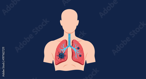 Detailed human torso illustration showing the lungs infected with coronavirus cells to highlight the impact of a respiratory virus.
