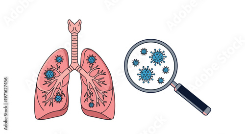 Detailed human lungs illustration infected with coronavirus cells and a magnifying glass zooming in on the blue virus particles.