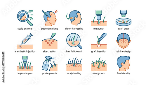 Hair transplant process steps illustrated with medical icons