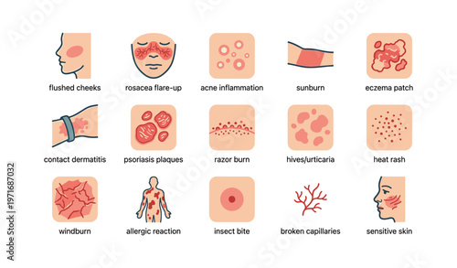 Skin conditions and reactions: identifying common dermatological issues and symptoms