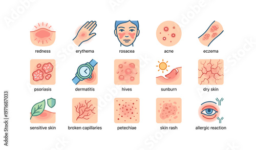 Skin conditions: rosacea, acne, eczema and more illustrated